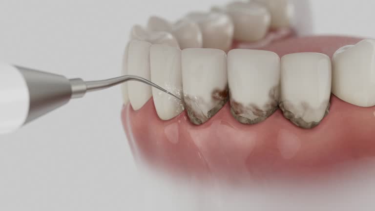 Reliable Dental contractor in Smithville, NJ by Smile Center Dentistry